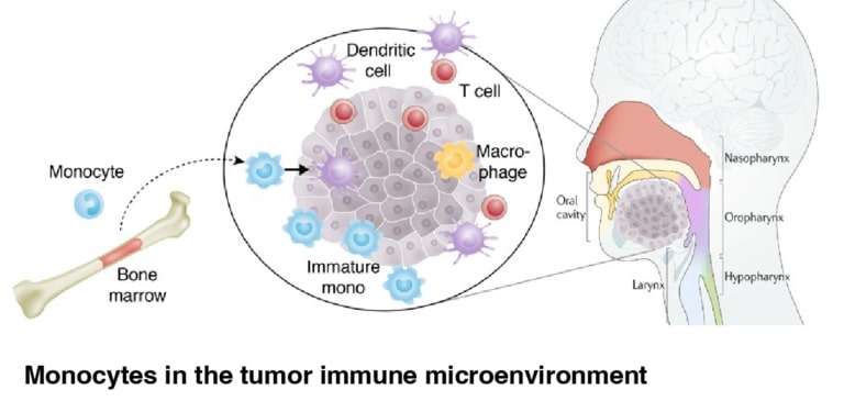 Monocytes in the tumor immune microenvironment.